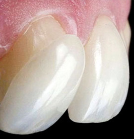 Specialised Dental Therapy